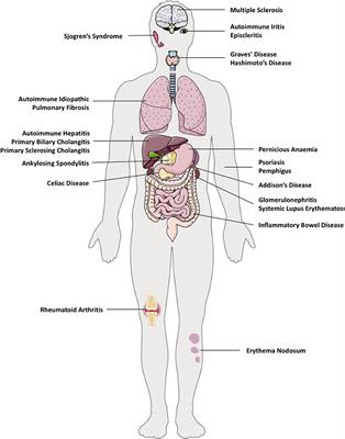 The Next Frontier of Regulatory T Cells: Promising Immunotherapy for Autoimmune Diseases and Organ Transplantations